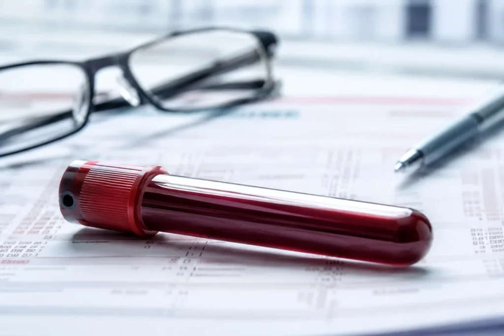 Tube à essai de sang sur résultats d'analyse médicale — bilan sanguin homme 35 ans et plus